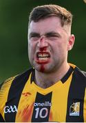 8 July 2022; Mick Kenny of Kilkenny receives medical attention during the GAA Football All-Ireland Junior Championship Semi-Final match between Kilkenny and London at the GAA National Games Development Centre in Abbotstown, Dublin. Photo by Stephen McCarthy/Sportsfile