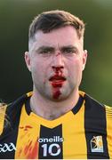 8 July 2022; Mick Kenny of Kilkenny awaits medical attention during the GAA Football All-Ireland Junior Championship Semi-Final match between Kilkenny and London at the GAA National Games Development Centre in Abbotstown, Dublin. Photo by Stephen McCarthy/Sportsfile