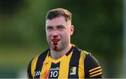 8 July 2022; Mick Kenny of Kilkenny awaits medical attention during the GAA Football All-Ireland Junior Championship Semi-Final match between Kilkenny and London at the GAA National Games Development Centre in Abbotstown, Dublin. Photo by Stephen McCarthy/Sportsfile