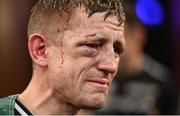 24 September 2022; Eric Donovan after his EBU European Union super-featherweight bout against Khalil El Hadri at the Europa Hotel in Belfast. Photo by Ramsey Cardy/Sportsfile