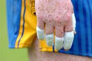 20 June 2004; A Roscommon player with his fingers taped up. Bank of Ireland Connacht Senior Football Championship Semi-Final, Leitrim v Roscommon, O'Moore Park, Carrick-on-Shannon, Co. Leitrim. Picture credit; David Maher / SPORTSFILE