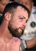 4 August 2023; Padraig McCrory after his super-middleweight bout against Steed Woodall during the Féile Fight Night at Falls Park in Belfast. Photo by Ramsey Cardy/Sportsfile