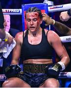 25 November 2023; Chantelle Cameron after her undisputed super lightweight championship fight with Katie Taylor at the 3Arena in Dublin. Photo by Stephen McCarthy/Sportsfile
