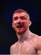 22 March 2024; (EDITOR'S NOTE; Image contains graphic content) Oscar Ownsworth after his lightweight bout against Alfie Davis during the Bellator Champions Series at the SSE Arena in Belfast. Photo by David Fitzgerald/Sportsfile