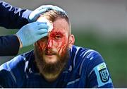 31 May 2025; (EDITORS NOTE: Image contains graphic content) RG Snyman of Leinster receives medical treatment during the United Rugby Championship quarter-final match between Leinster and Scarlets at the Aviva Stadium in Dublin. Photo by Seb Daly/Sportsfile