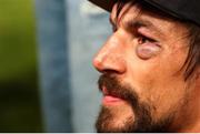 31 May 2025; Hollywoodbets Sharks captain Eben Etzebeth swollen eye after the United Rugby Championship quarter-final match between Hollywoodbets Sharks and Munster at Kings Park Stadium in Durban, South Africa. Photo by Shaun Roy/Sportsfile