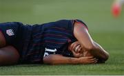 26 June 2025; Michelle Cooper of United States reacts after sustaining an injury following a tackle from Chloe Mustaki of Republic of Ireland, not pictured, during the women's international friendly match between the USA and Republic of Ireland at Dick’s Sporting Goods Park in Commerce City, Colorado, USA. Photo by Stephen McCarthy/Sportsfile
