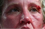 8 July 2025; (EDITORS NOTE: Image contains graphic content)  Colleen Davis after her super featherweight bout with Elise Soto held at The Oculus at World Trade Center in New York, USA, as part of the open workout event in the build up to the undisputed super lightweight championship fight between Katie Taylor and Amanda Serrano, on July 11th at Madison Square Garden in New York. Photo by Stephen McCarthy/Sportsfile