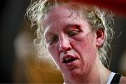 8 July 2025; (EDITORS NOTE: Image contains graphic content)  Colleen Davis after her super featherweight bout with Elise Soto held at The Oculus at World Trade Center in New York, USA, as part of the open workout event in the build up to the undisputed super lightweight championship fight between Katie Taylor and Amanda Serrano, on July 11th at Madison Square Garden in New York. Photo by Stephen McCarthy/Sportsfile