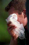 29 September 1999; David Corkery puts ice on his eye after picking up an injury during an Ireland Rugby training session at King's Hospital in Palmerstown, Dublin. Photo by Aoife Rice/Sportsfile