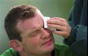 29 September 1999; David Corkery has his eye attended to by the team physiotherapist Denise Fanagan during an Ireland Rugby training session at King's Hospital in Palmerstown, Dublin. Photo by Aoife Rice/Sportsfile