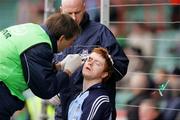 25 March 2007; Dublin's Derek O'Reilly receives stitches to a head injury from Dr Dave Boylan. O'Reilly returned to the action after treatment. Allianz National Hurling League, Division 1B, Round 4, Limerick v Dublin, Gaelic Grounds, Limerick. Picture credit: Kieran Clancy / SPORTSFILE
