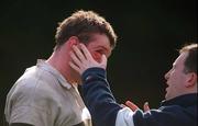 11 March 2000; Rob Cole of Wanderers has an eye injury attended to by Dr Liam O'Connell during the AIB All-Ireland League Division 2 match between Wanderers and Dolphin at Wanderers RFC in Merrion Road, Dublin. Photo by Ray McManus/Sportsfile