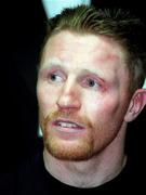 18 March 1995; Steve Collins shows the scars of battle following victory during his WBO Super-Middleweight Title Fight against Chris Eubank at Green Glens Arena in Millstreet, Cork Boxing. Photo by David Maher/Sportsfile