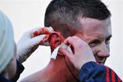 9 April 2008; Padraic O'Connor, Mayo, receives attention for a cut during the game. Cadbury's Connacht U21 Football Championship Final, Roscommon v Mayo, Kiltoom, Co. Roscommon. Picture credit: David Maher / SPORTSFILE