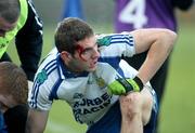 14 December 2008; Kevin McGuckin, Ballinderry, waits to get blood washed out of his eye after a high challenge. AIB Ulster Senior Club Football Championship Final Replay, Crossmaglen Rangers v Ballinderry, Brewster Park, Enniskillen, Co. Fermanagh. Picture credit: Oliver McVeigh / SPORTSFILE