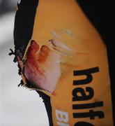 21 May 2009; Ian Wilkinson, Halfords Bike Hut, shows the results of a crash. FBD Insurance Ras 2009, Stage 5, Killorglin – Scariff. Picture credit: Stephen McCarthy / SPORTSFILE