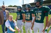 2 September 2016; Special Olympics Athlete Fiona Bryson conducts the coin toss ahead of the Blessed Trinity v St. Peters Prep game. Donnybrook Stadium hosted a triple-header of high school American football games today as part of the Aer Lingus College Football Classic. Six top high school teams took part in the American Football Showcase with all proceeds from the game going to Special Olympics Ireland, the official charity partner to the Aer Lingus College Football Classic. High School American Football Showcase match between Blessed Trinity of Atlanta, Georgia and St. Peters Prep of Jersey City, New Jersey at Donnybrook Stadium in Dublin. Photo by Piaras Ó Mídheach/Sportsfile