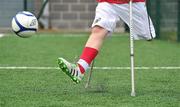 18 June 2010; A general view of amputee football during Ireland's first amputee football club training session. Mountview Communinty Sports Centre, Clonsilla, Co. Dublin. Picture credit: Brendan Moran / SPORTSFILE