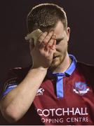10 March 2017; Luke Gallagher of Drogheda United makes his way off the pitch after sustaining an injury to his eye during the SSE Airtricity League Premier Division game between Drogheda United and Cork City at United Park in Drogheda, Co. Louth. Photo by Eóin Noonan/Sportsfile