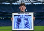 10 May 2017; Bord Gáis Energy today launched its new #HurlingToTheCore campaign at Croke Park to mark the beginning of a summer of hurling.  #HurlingToTheCore celebrates Bord Gáis Energy’s belief that hurling is more than a sport or pastime - it is deeply ingrained in Irish history and stitched into our national identity. In attendance at the Bord Gáis Energy Summer of Hurling Launch is Patrick Curran of Waterford. Croke Park in Dublin. Photo by Sam Barnes/Sportsfile