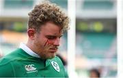 17 June 2017; Finlay Bealham of Ireland leaves the pitch with an eye injury after the international rugby match between Japan and Ireland at the Shizuoka Epoca Stadium in Fukuroi, Shizuoka Prefecture, Japan. Photo by Brendan Moran/Sportsfile