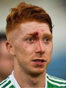 19 August 2017; Cian Lynch of Limerick after the Bord Gáis Energy GAA Hurling All-Ireland U21 Championship Semi-Final match between Galway and Limerick at Semple Stadium in Tipperary. Photo by Daire Brennan/Sportsfile