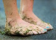 16 August 2012; An athlete's feet after the Athletics Ireland Barefoot Mile. Athletics Ireland Barefoot Mile, Leopardstown Racecourse, Leopardstown, Co. Dublin. Picture credit: Pat Murphy / SPORTSFILE