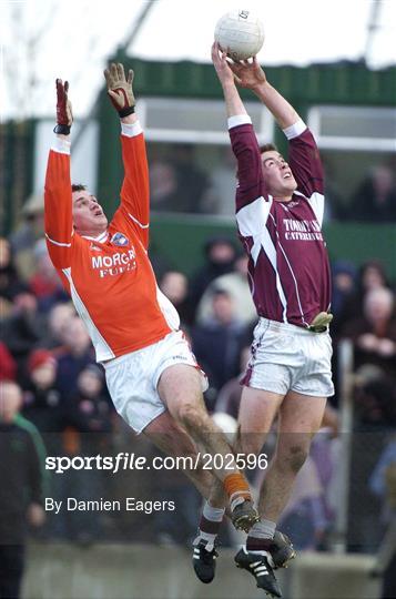 Armagh v Galway - NFL