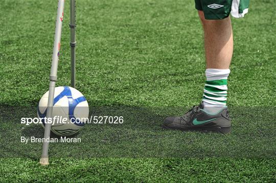 Ireland's First Amputee Football Club Training Session Ireland's First Amputee Football Club Training Session