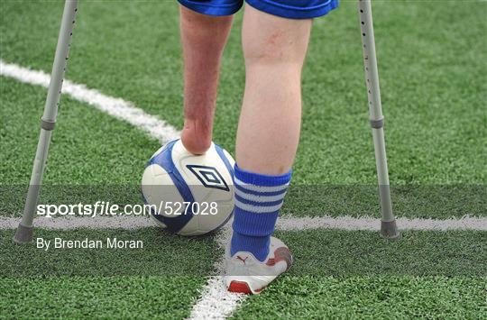 Ireland's First Amputee Football Club Training Session