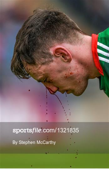 Mayo v Sligo - Connacht GAA Football Senior Championship Quarter-Final